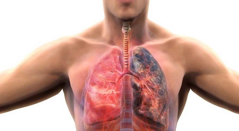KOAH Hastalarında Evde Doktor Takibi Nasıl Yapılır? Solunum Sağlığında Düzenli Kontrolün Önemi